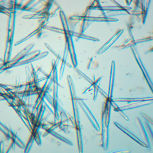 Сила микроигл: спикулы в косметологии