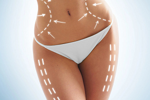 Современные методы быстрого моделирования тела за минимальное время: массажер для моделирования фигуры  "ENDOBODY PRO" AMG1100, GEZATONE